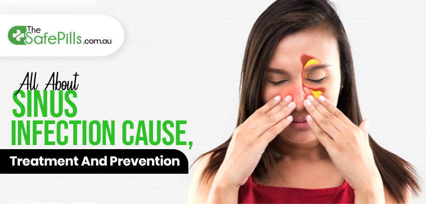All About Sinus Infection Cause, Treatment And Prevention